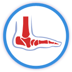 Charcot Arthropathy