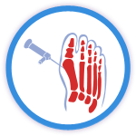 Minimally Invasive Bunion